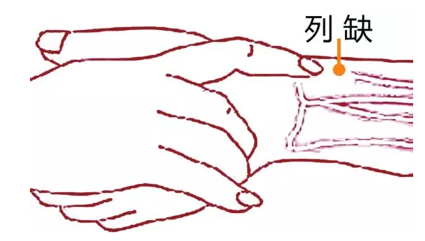 34.png