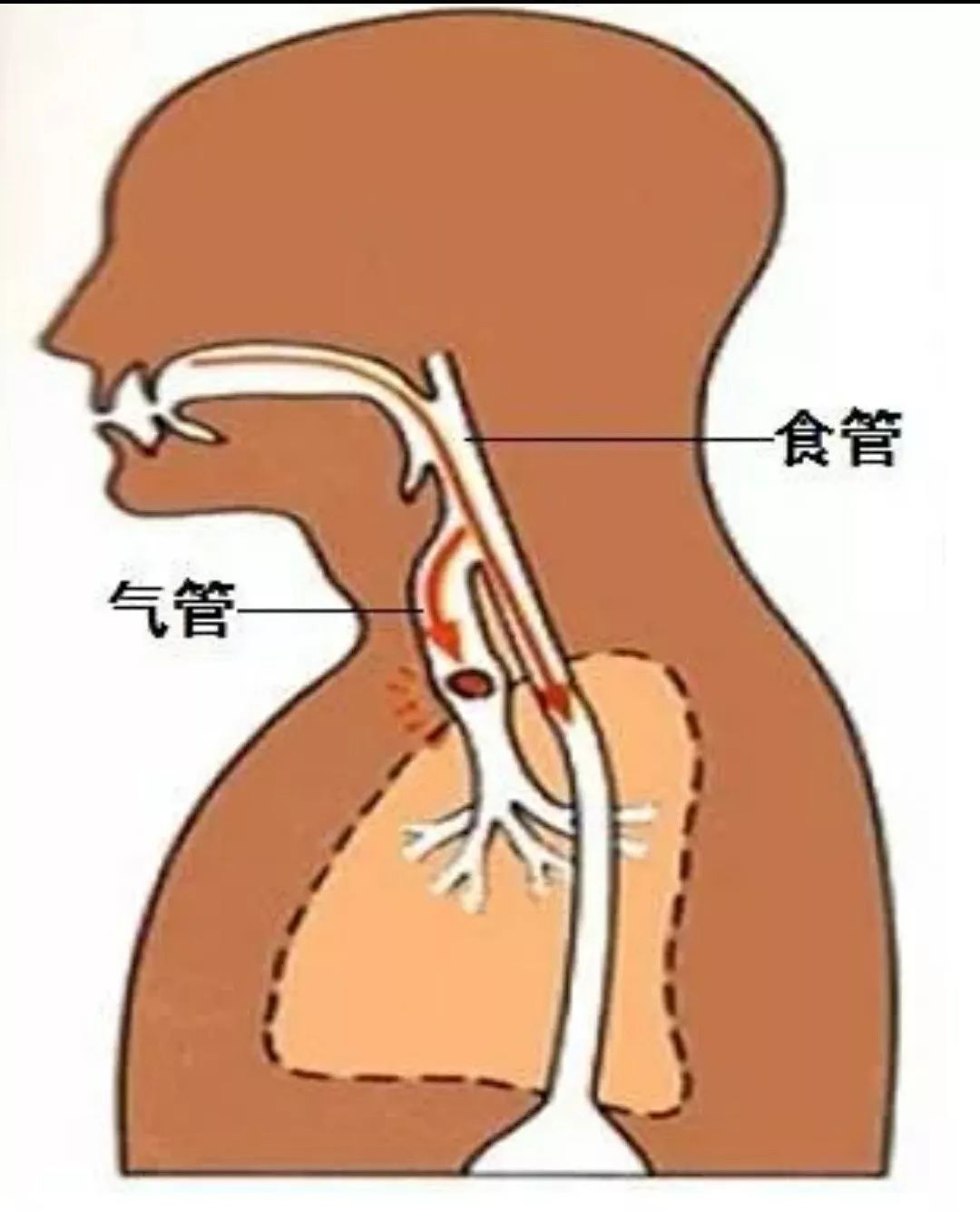 食道部位图咽喉分界图图片